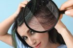 Узнайте, как избавиться от перхоти народными методами в домашних условиях. Причины появления, эффективные рецепты и профилактика. Натуральный подход к здоровой коже головы.