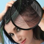 Узнайте, как избавиться от перхоти народными методами в домашних условиях. Причины появления, эффективные рецепты и профилактика. Натуральный подход к здоровой коже головы.