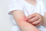 Узнайте, как отличить укус клопа, чем лечить поражение и как быстро снять покраснение после укуса. Практические советы для безопасного и эффективного ухода.